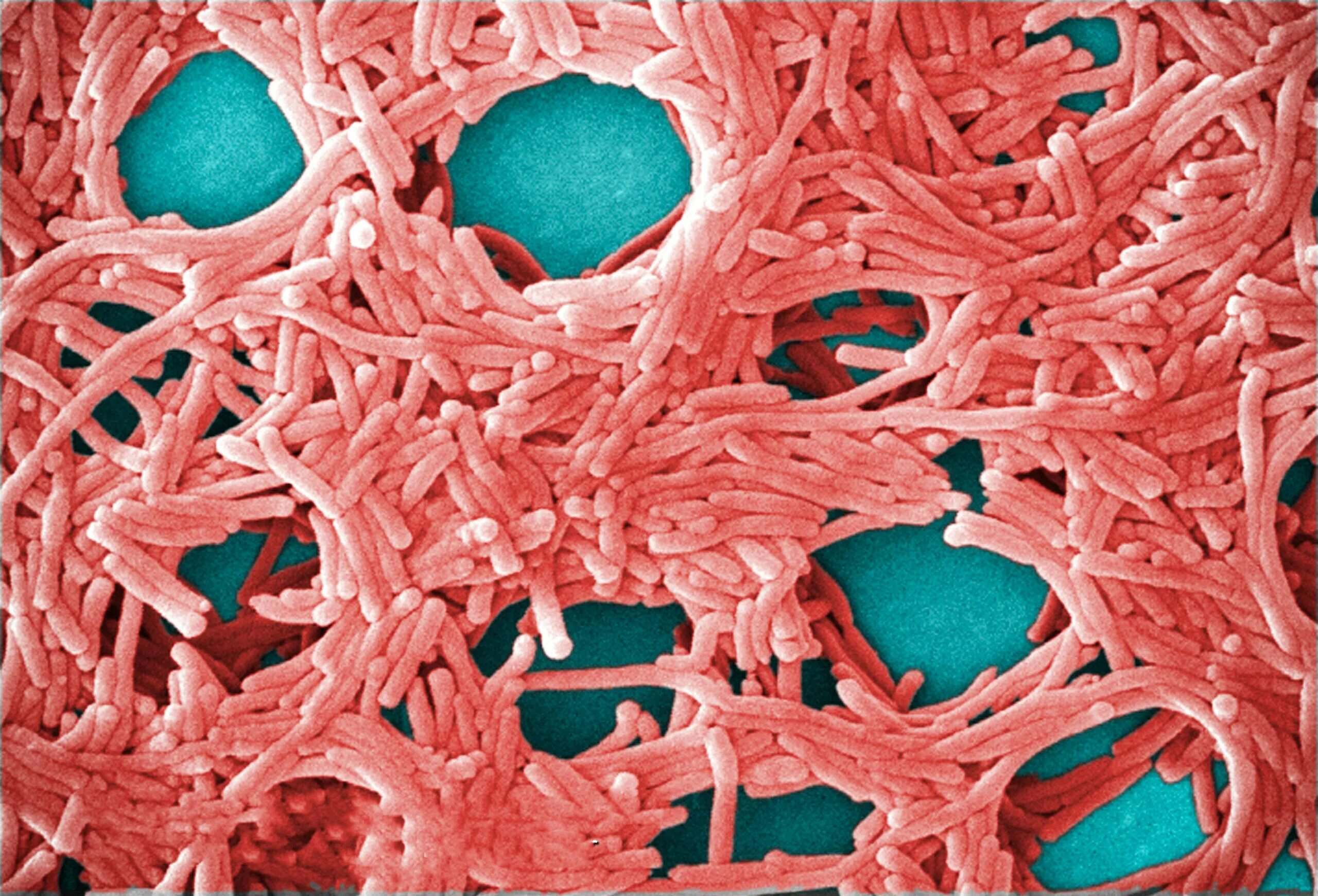 Возбудитель легионеллы. Возбудитель легионеллеза микробиология. Бактерия легионелла. Легионелла пневмофила. Легионелла возбудитель.