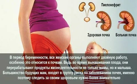 Боль в почках при беременности