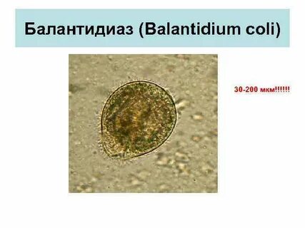 Балантидиаз это