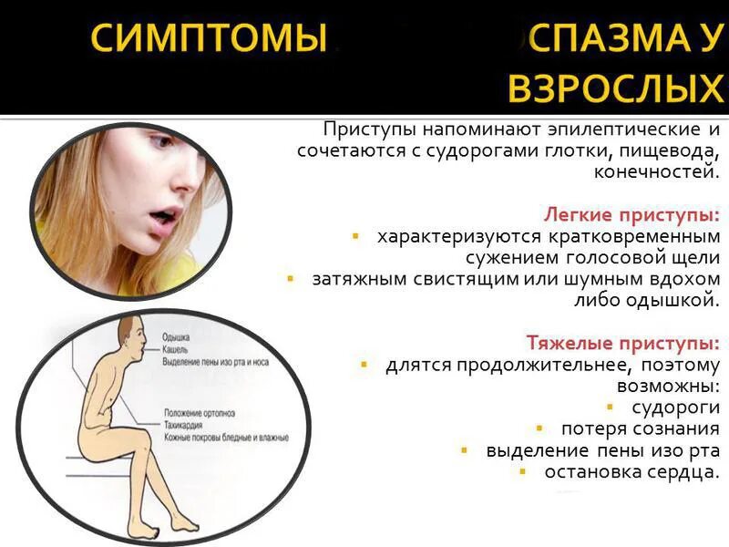 Как снять спазм в горле. Клинические симптомы ларингоспазма. ларингоспазм у взрослых симптомы. ларингоспазм клинические проявления. ларингоспазм у взрослых причины.