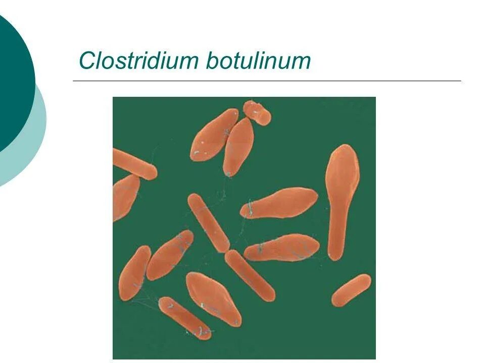 Клостридии ботулизма ( Clostridium botulinum ) ботулизм. Clostridium botulinum – это микроорганизм. Бактерия клостридия ботулинум. Клостридиум ботулинум морфология.