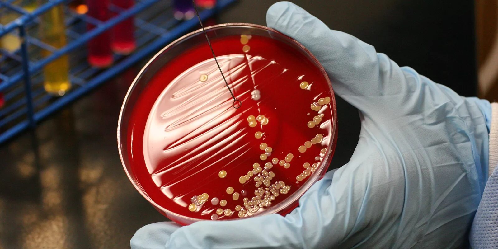 Посев мокроты на туберкулез. Бактериологическое исследование мочи. Принципы лечения бактериальных инфекций. Забор материала для бактериологического исследования. Бактериологическое исследование кала бак посев.