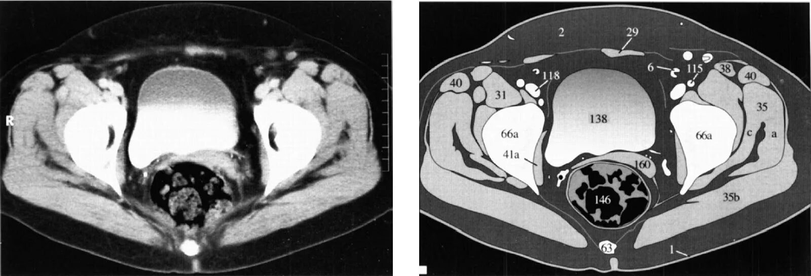 Кт анатомия органов грудной клетки. Срезы кт. Аксиальный сред при кт. Срезы кт. Кт анатомия брюшной полости.
