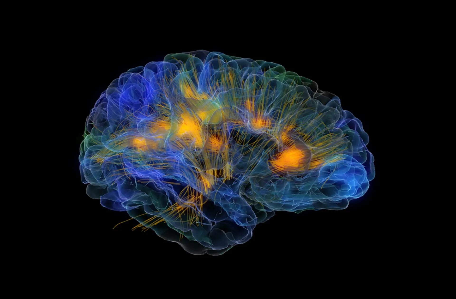 R brain