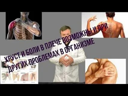 Хруст в плечевом суставе при вращении причины