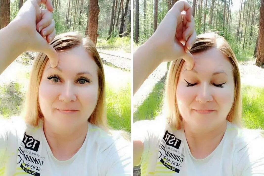 Нависшее веко тейпирование нависшего века. Тейпы для лица для нависшего века. тейпирование лица для нависшего века. массаж глаз для нависшего века. тейпирование лица при нависшем веке.