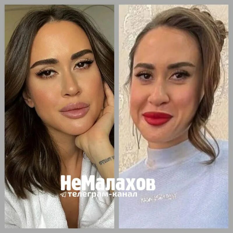 Татьяна плаксина до и после пластики Новый роман Нежности Татьяны Плаксиной с высоким брюнетом попали на камеру Эк