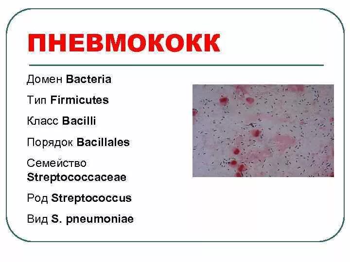 Streptococcus pneumoniae haemophilus influenzae streptococcus. Streptococcus pneumoniae haemophilus influenzae streptococcus