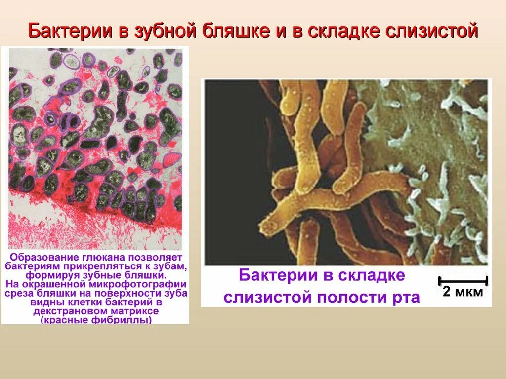 Микроорганизмы зубной бляшки. Зубная бляшка микробиология. Микробиология ротовой полости. Микроорганизмы в ротовой полости микробиология. Бактерии в слюне