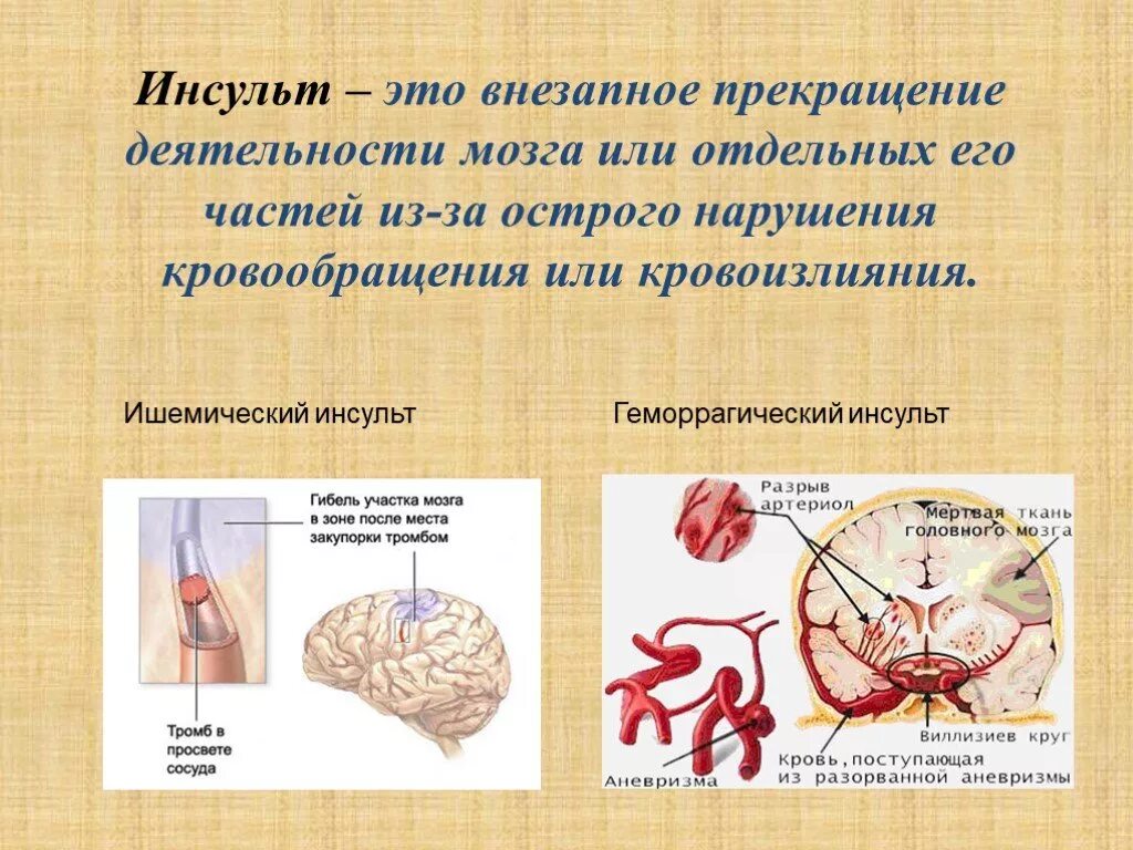 Курсовая инсульт. Презентация на тему инсульт. Ишемический инсульт презентация.