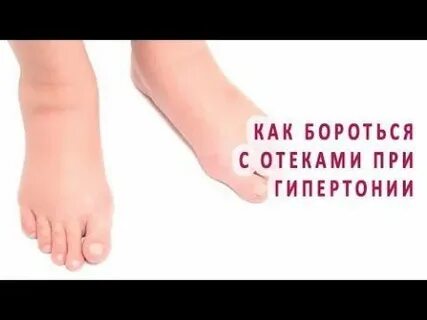 Как бороться с отеками