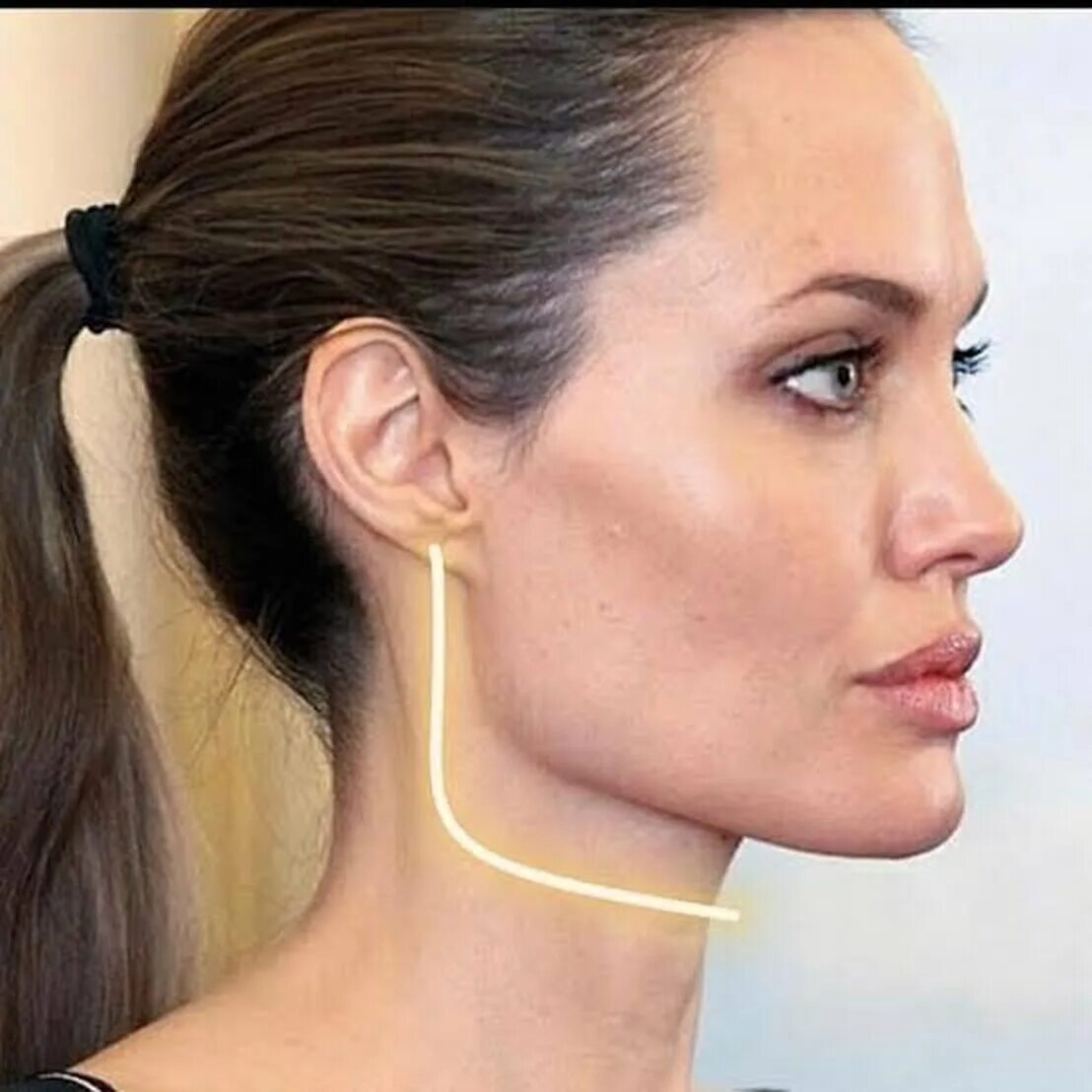 Ринопластика. Девушка в профиль. Профиль джоли - углы нижней челюсти. Скулы анджелины джоли. Ментопластика (гениопластика).