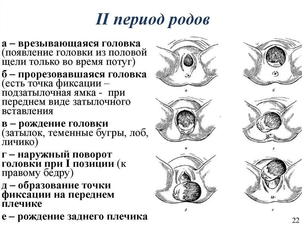 Фазы второго периода родов. Врезывание и прорезывание головки. Периоды родов Длительность родов.