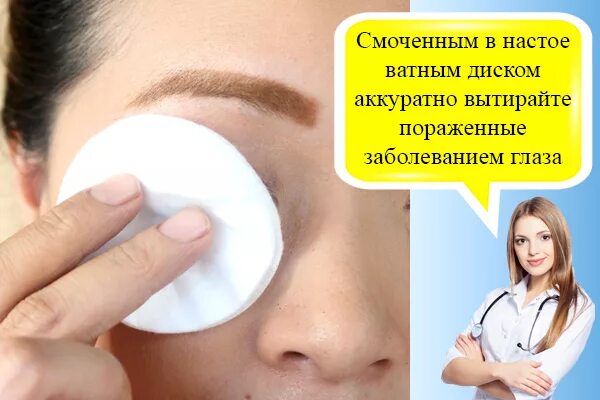 Промывать глаза ватным диском. Ватные диски на глазах. Протирает шею ватным диском. Промывание глаз при конъюнктивите фурацилином.