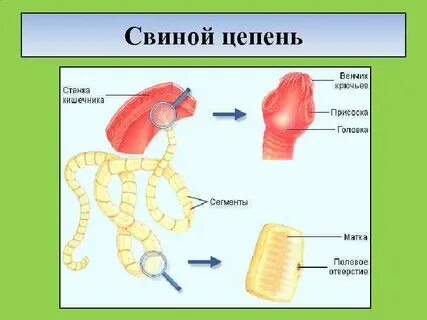 Матка свиного цепня