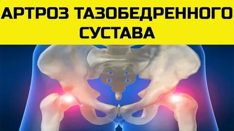Почему щелкают суставы