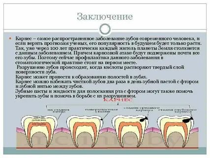 Кариес причины