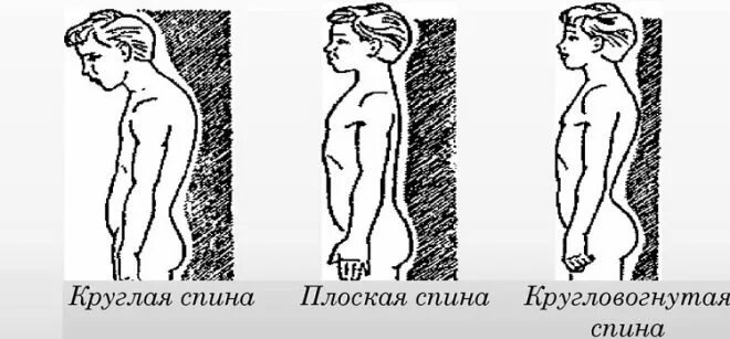 Вогнуто круглая спина. Вогнуто круглая спина. Кифоз грудного отдела позвоночника 2 степени. Круглая спина. Массаж при нарушении осанки.