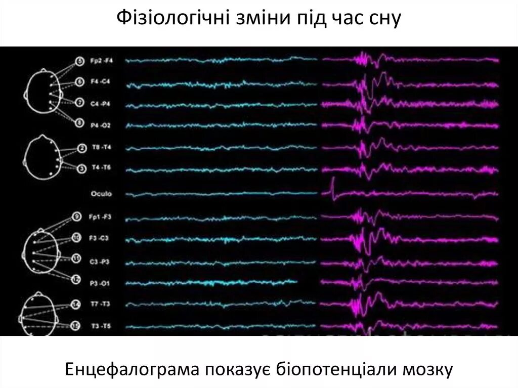 Ээг головного мозга что показывает. Ээг. электрическая активность мозга. мозг активность ээг. мозг человека энцефалограмма.