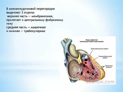 Межжелудочковая перегородка это