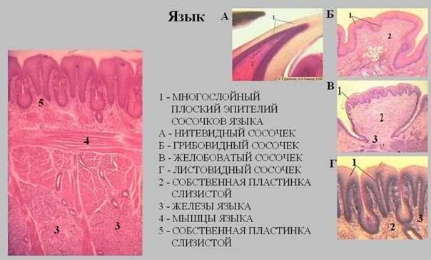 Нитевидные сосочки гистология. Листовидный сосочек языка гистология препарат. Гистология язык сосочки эпителий. Препарат листовидные сосочки языка гистология с подписями.