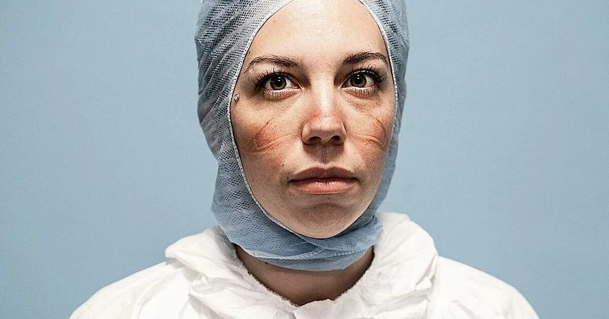 Лицо врача. Следы от масок на лицах врачей. Фото итальянского врача. Лица медиков после масок.