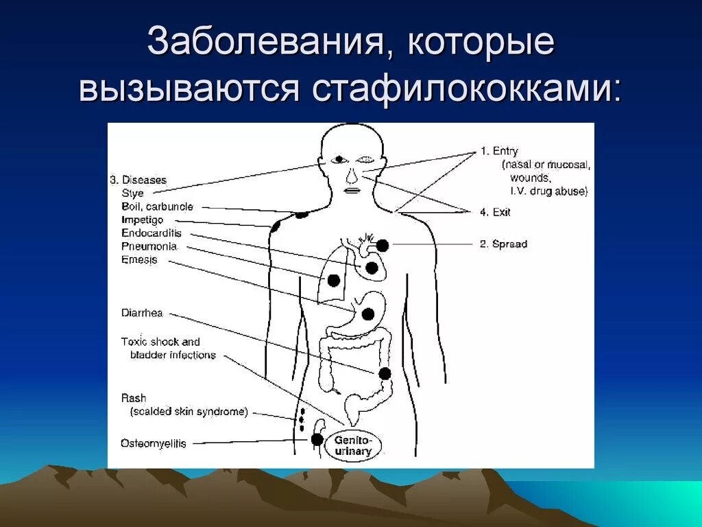 Какое заболевание вызывает стафилококк. Стафилококк заболевания. Болезни вызываемые стафилококками. Заболевания, вызываемые стафилококковой инфекцией.. Симптомы стафилококковой инфекции.