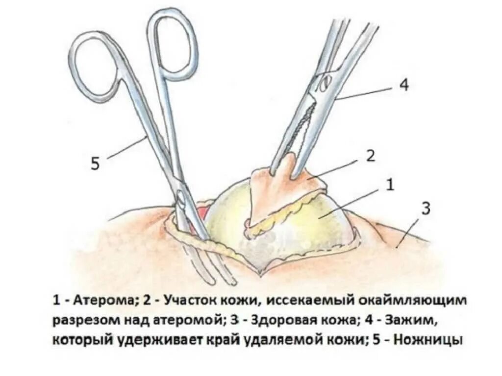 Как выглядит как проходит
