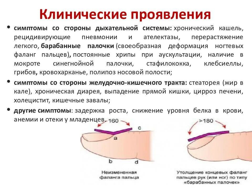 Муковисцидоз клинические признаки. Муковисцидоз клинические проявления. Смешанная форма муковисцидоза. Муковисцидоз клинические проявления. Генетическое заболевание муковисцидоз.