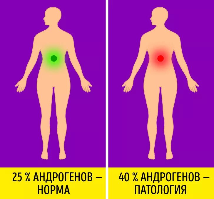 Андрогены в женском организме. Андрогенный гормональный Тип женщины. Избыток половых гормонов андрогенов. Избыток эстрогенов и андрогенов. Как избавится от мужских гормонов