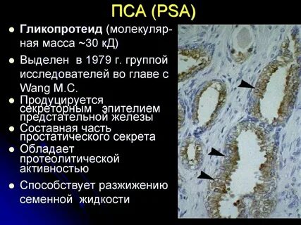 Простатический специфический антиген пса норма