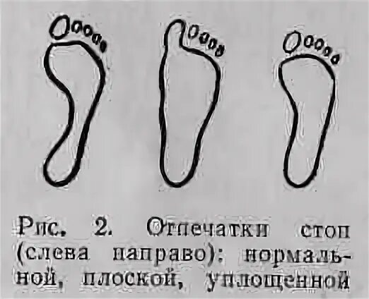 Стопа слева