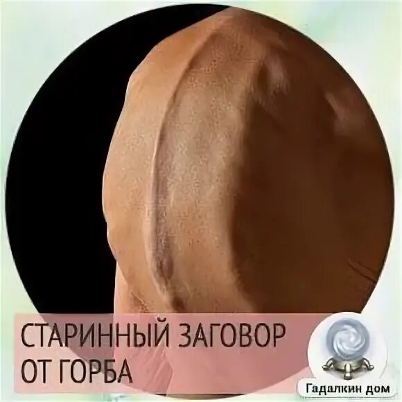 Горбы несущие