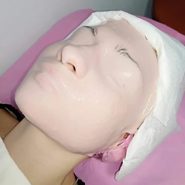 Альгинатная маска. Альгинатная маска для лица. Альгинальеая маска на лице. Альгинпньгая маска на лице.