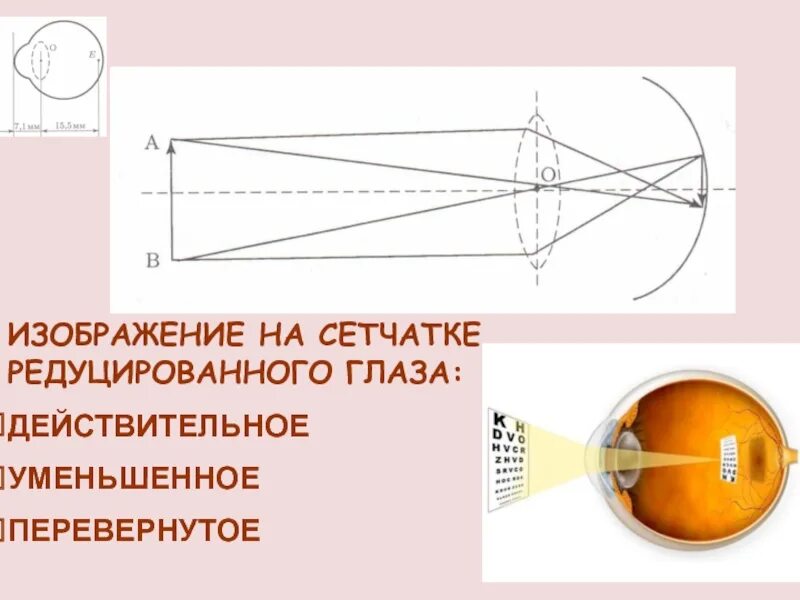 Уменьшенное перевернутое изображение линзы. Изображение на сетчатке глаза действительное. перевернутое изображение на сетчатке. изображение на сетчатке уменьшенное перевернутое. изображение на сетчатке глаза действительное перевернутое.