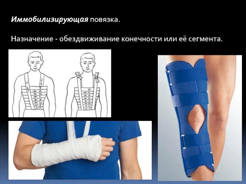 Классификация иммобилизирующих повязок. Наложение иммобилизирующей повязки. Иммобилизирующие повязки хирургия. Виды транспортной иммобилизации при переломах. Транспортная иммобилизация при переломе шейного отдела позвоночника.
