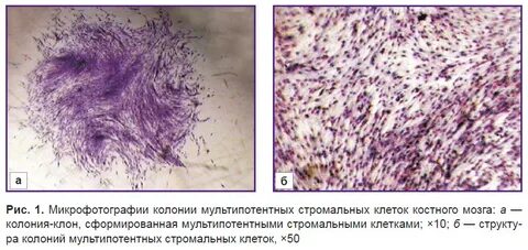 Пролиферация клеток костного мозга
