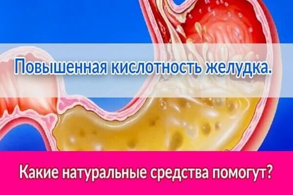 Повышенная кислотность лечение у взрослых. Повышенная кислотность. Повышенный кислотность желудка. Высокая кислотность желудка. Повышение кислотности желудка симптомы.