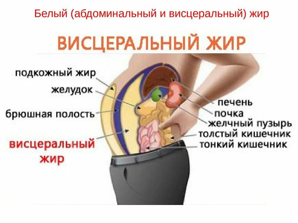 Висцеральное ожирение у мужчин. Висцеральное ожирение у мужчин. Абдоминальное и висцеральное ожирение. Висцеральное ожирение у мужчин. Что такое абдоминальное ож.