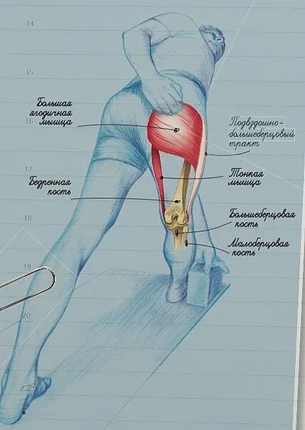 Растяжение седалищный