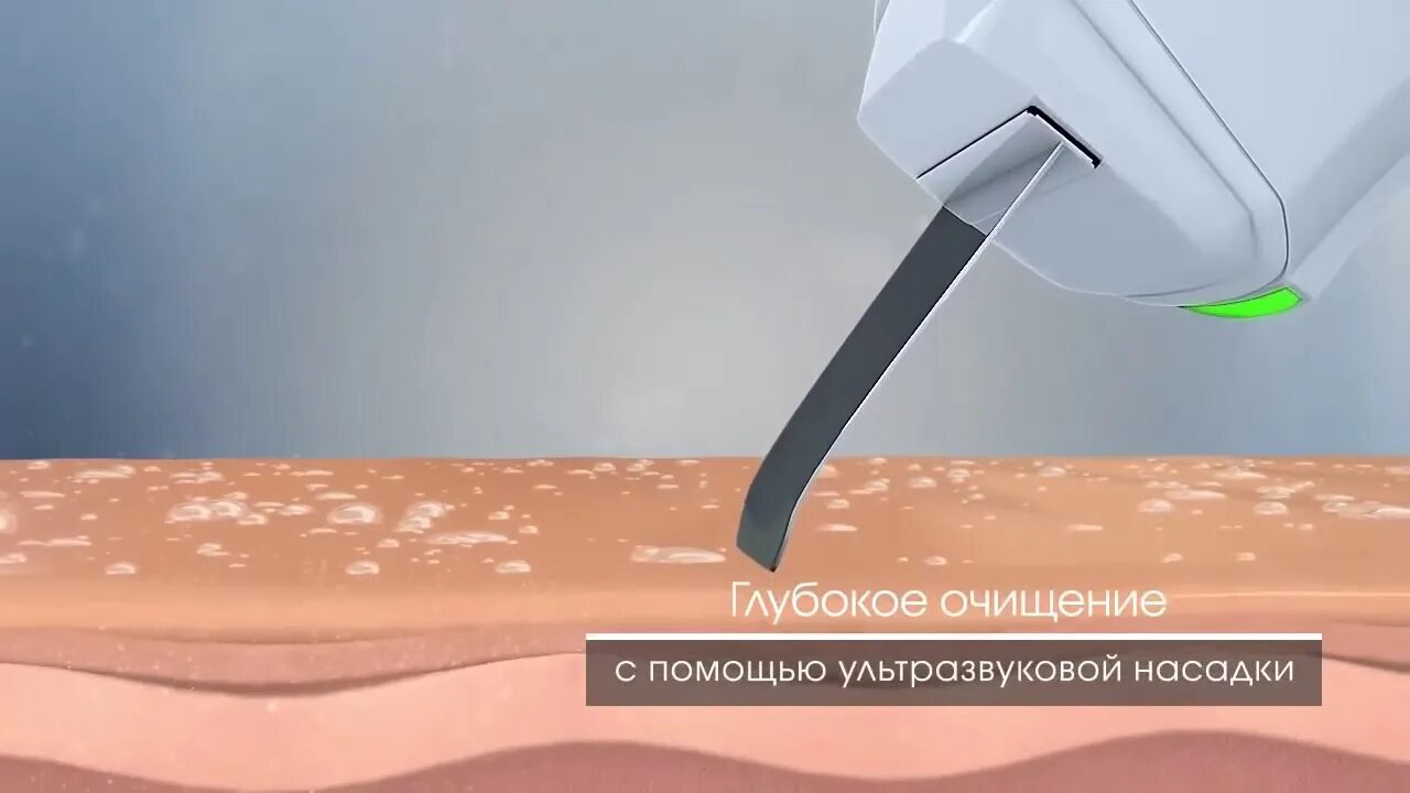 Чистка мц