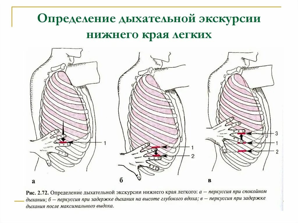 Подвижность Нижнего легочного края перкуссия. Экскурсия , подвижность Нижнего края легких. Экскурсия нижних краев легких. Определение активной экскурсии Нижнего края легких. Нижний легочный край