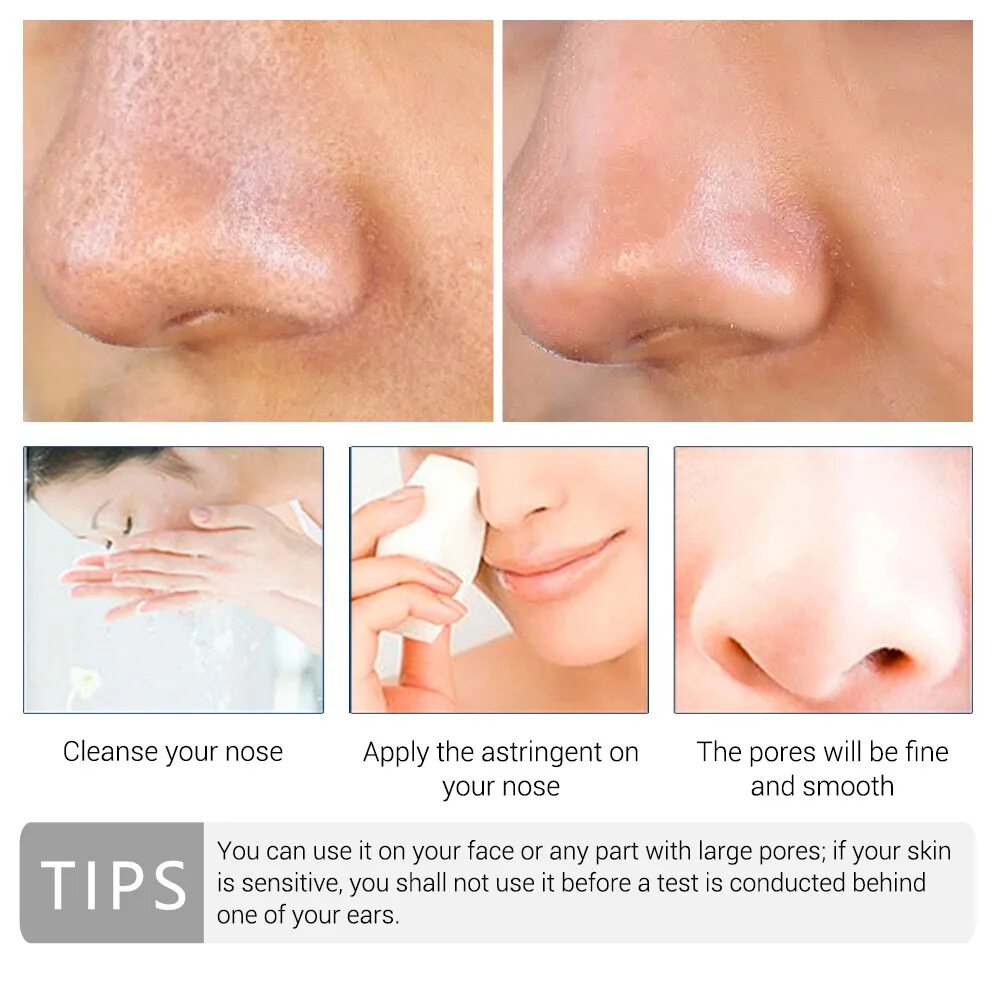 Ланбена серум для лица для сужения пор. Средство от расширенных пор на лице. Кислота сужающая поры. Кислота сужающая поры. Средство от сужения пор на лице.