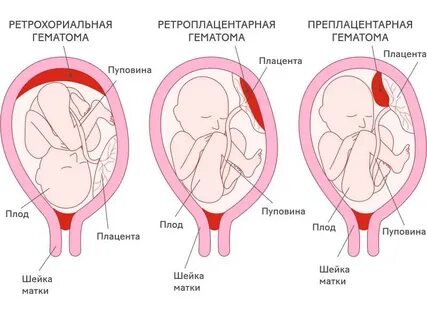 Анальды секс алдында клизма жасау керек пе?