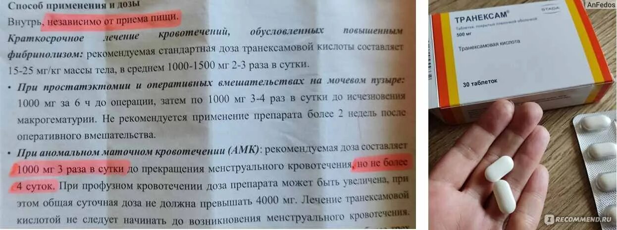 Как действует транексам при маточном кровотечении. Как действует транексам при маточном кровотечении