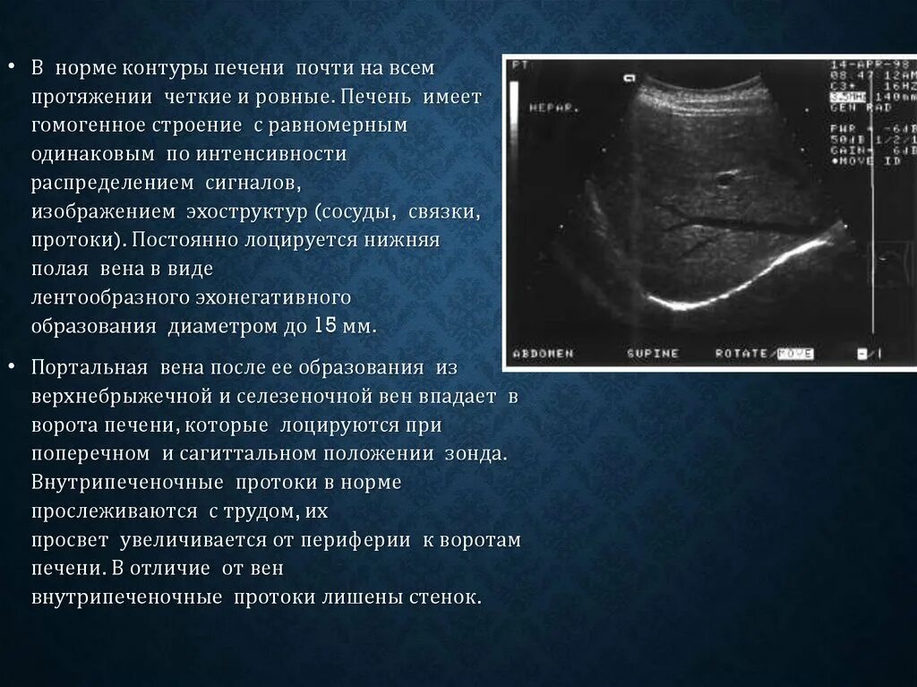 Квр печени увеличена. Контур печени ровный. УЗИ печени норма. Контуры ровные четкие печени что это.