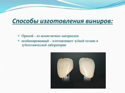 Виниры прямой метод
