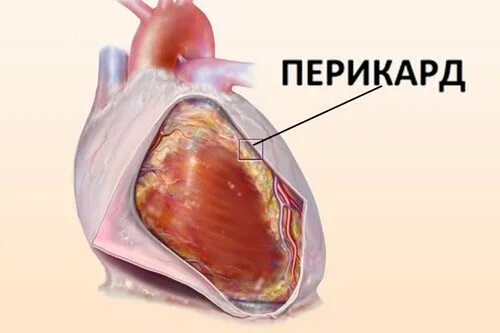 Жидкость в сердце что это такое