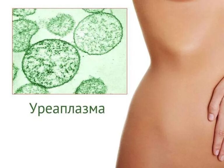 Уреаплазма микрофлора. Микоплазмоз, уреаплазмоз, хламидиоз. уреаплазмоз у женщин фото. венерические заболевания уреаплазма.