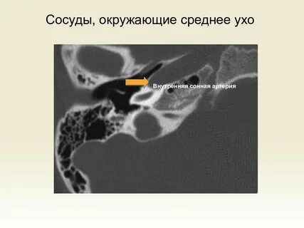 Кт уха